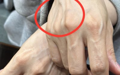 Si tienes venas visibles, significa que estás… Ver más…