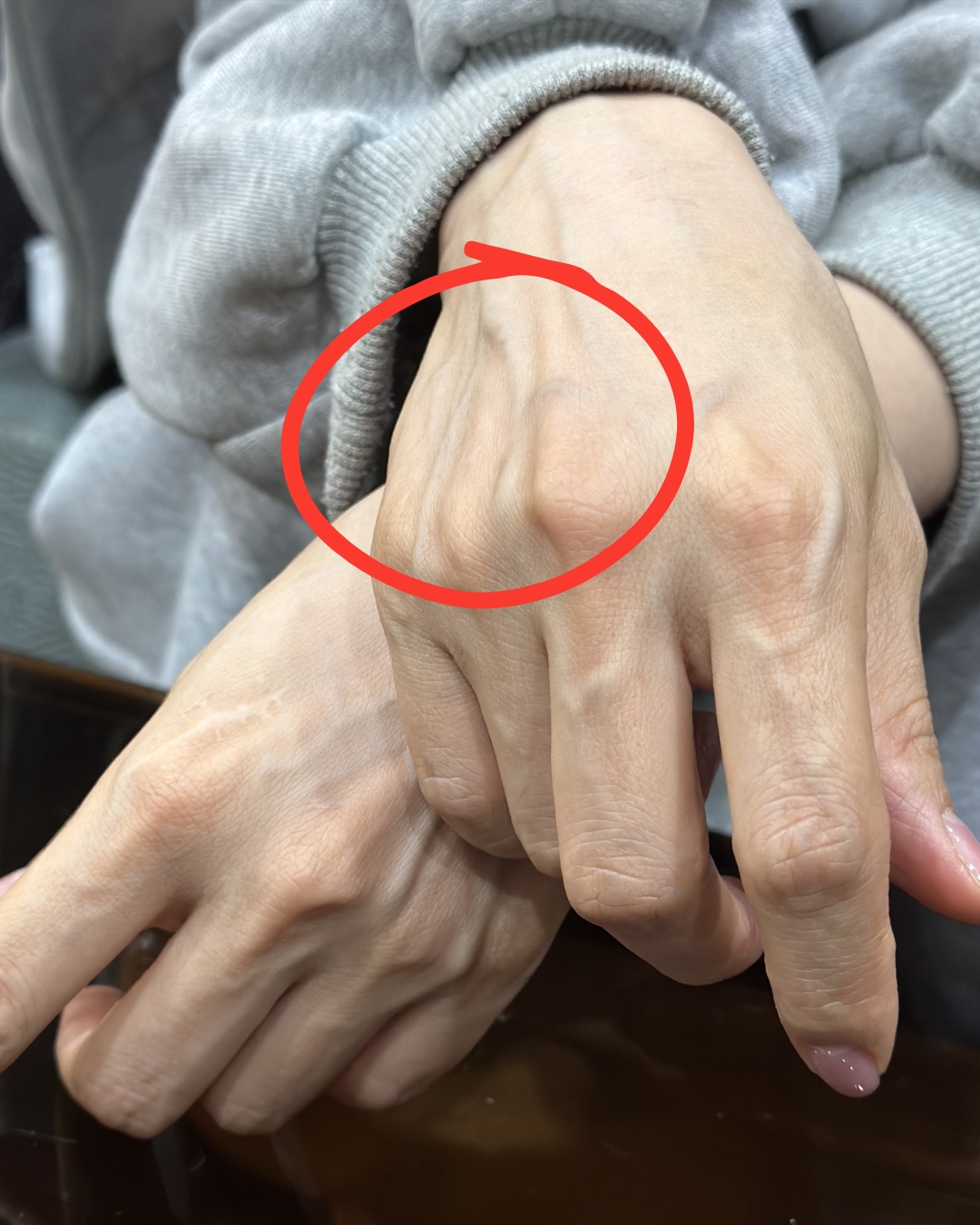 Si tienes venas visibles, significa que estás… Ver más…
