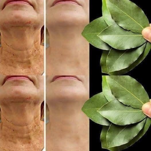 Es el laurel 100.000 veces más efectivo que el bótox? | Eliminador de arrugas natural, ¡incluso a los 70!