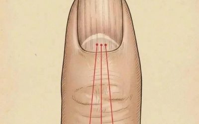LÍNEAS EN LAS UÑAS Y CONSEJOS PARA SOLUCIONARLO