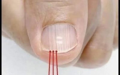 LÍNEAS EN LAS UÑAS Y CONSEJOS PARA SOLUCIONARLO