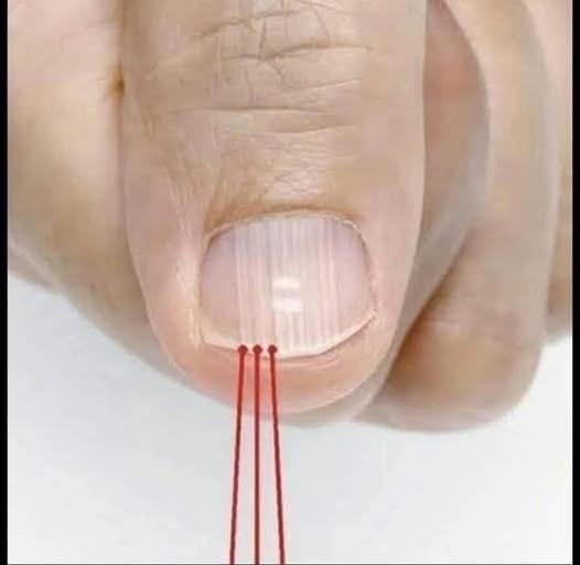 LÍNEAS EN LAS UÑAS Y CONSEJOS PARA SOLUCIONARLO