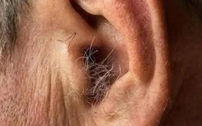 ¿LO SABÍAS? Si te crece vello en las orejas, es porque tu cuerpo está…