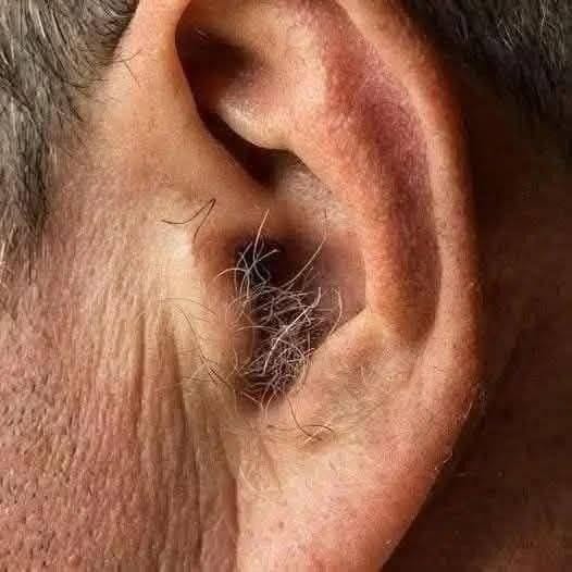 ¿LO SABÍAS? Si te crece vello en las orejas, es porque tu cuerpo está…