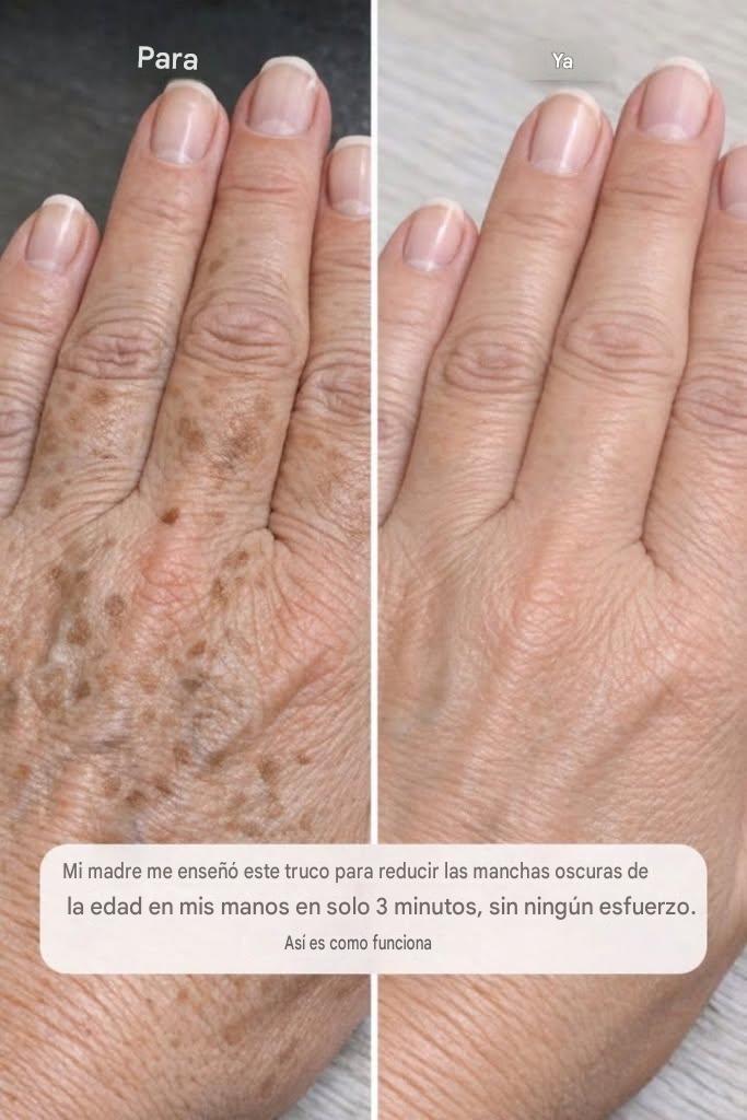 Mi madre me enseñó este truco para reducir las manchas oscuras de la edad en mis manos en solo 3 minutos y sin ningún esfuerzo. Así es como funciona:
