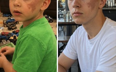 “15 años después de perder a mi hijo, un extraño entró en mi vida… y me reconoció. Hace quince años, enterré a mi hijo de cuatro años, Howard. Era tan pequeño… demasiado pequeño para un ataúd, demasiado joven para una despedida tan definitiva. Me dijeron que había sido algo repentino. Una infección rara. Impredecible. Inevitable. Palabras destinadas a consolar, pero que solo resonaban en el vacío que vino después. Recuerdo haber firmado documentos con la vista borrosa, con las manos temblando. Recuerdo que alguien me aconsejó con suavidad que no lo mirara durante demasiado tiempo. —Aférrese a los recuerdos de él cuando estaba vivo —me dijeron. Y eso intenté. La vida no se detuvo después del funeral. Simplemente… se volvió más tenue. Más silenciosa. Se redujo a algo que apenas reconocía. Años después, me mudé a otra ciudad. Un nuevo comienzo, lo llamaban. Encontré trabajo en un pequeño café de una calle concurrida, un lugar donde nadie conocía mi pasado, donde podía existir sin preguntas. Con el tiempo, aprendí a funcionar de nuevo. A escuchar risas sin derrumbarme. A respirar a través del silencio. Pero algunos recuerdos nunca desaparecen. Como la marca de nacimiento. Pequeña. Ligeramente irregular. Justo debajo de su oreja izquierda. Solía besarla todas las noches antes de que se durmiera. No había pensado en ella durante años. Hasta ayer. Era una tarde cualquiera: pedidos acumulándose, voces mezclándose en el ruido. Entonces entró un joven. Diecinueve años, quizá veinte. Alto. Nada fuera de lo común a primera vista. Se acercó al mostrador. —Un café negro —dijo simplemente. Asentí y me giré hacia la máquina. Y fue entonces cuando la vi. Cuando inclinó la cabeza… Allí estaba. La misma marca. La misma forma. El mismo lugar. Todo dentro de mí se paralizó. No… tenía que ser una coincidencia. Las marcas de nacimiento no son algo raro. Mucha gente las tiene. Eso fue lo que me repetí mientras apretaba la taza de café más de lo necesario, intentando controlar el temblor de mis manos. Pero no podía dejar de mirarlo. Cuando le entregué la taza, nuestros dedos se rozaron. Él levantó la vista. Me miró de verdad. Y algo cambió en su expresión. Confusión. Luego algo más profundo… como reconocimiento. Frunció ligeramente el ceño. —Espera… —dijo lentamente—. Yo la conozco. Y así, en un instante, todo lo que había enterrado quince años atrás volvió a salir a la superficie. …Continuará en los comentarios.
